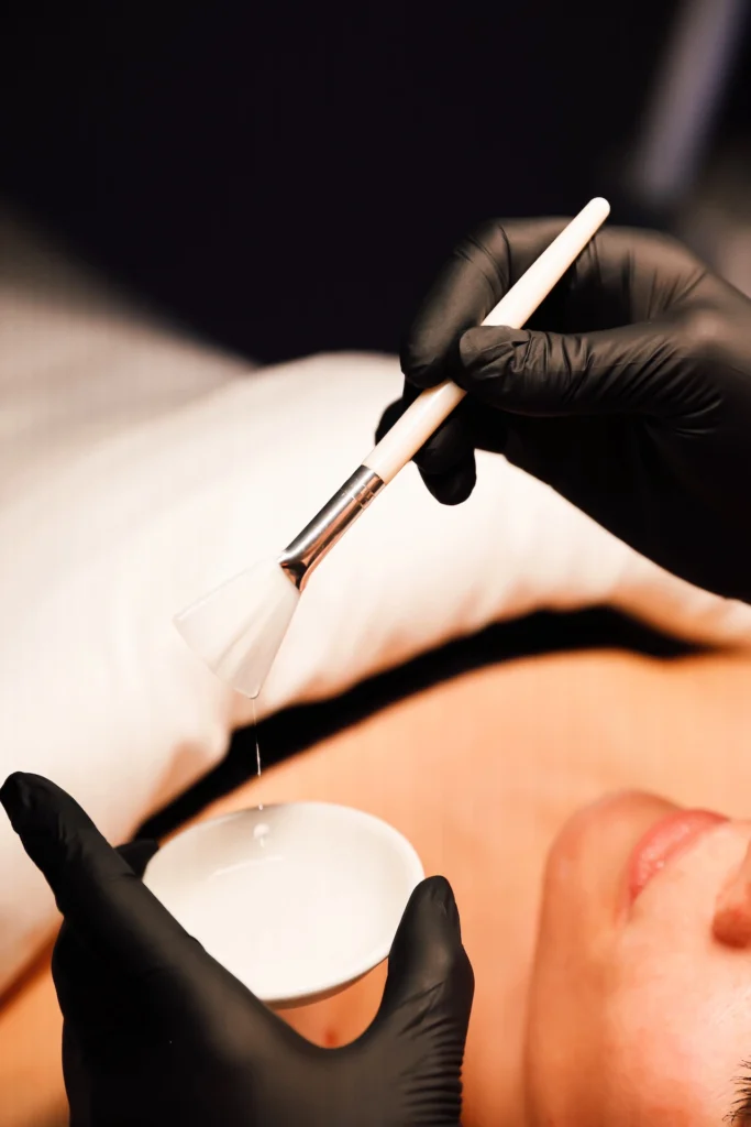 Medical grade chemical peel